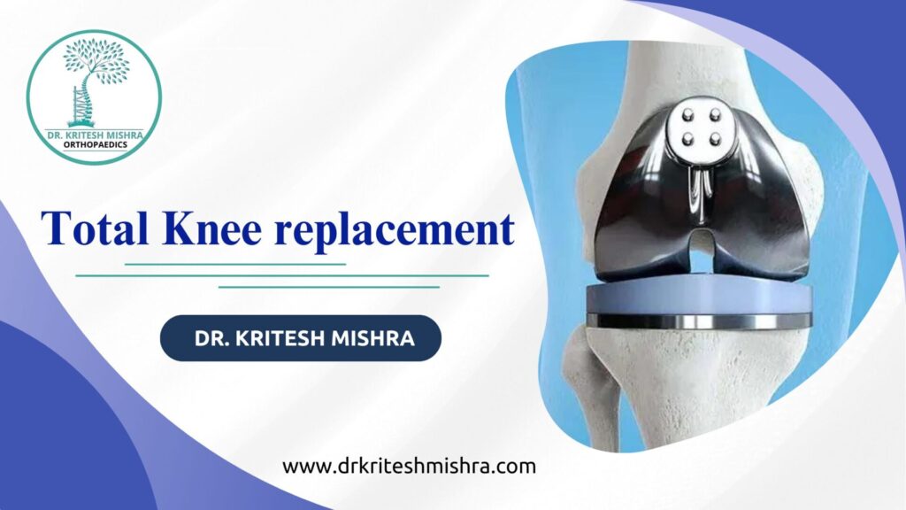 Total Knee replacement