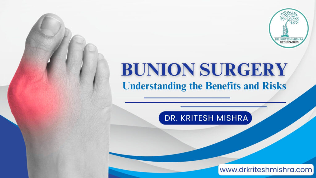 Bunion Surgery