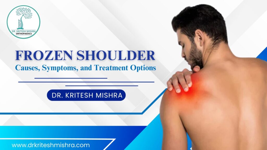 Frozen Shoulder